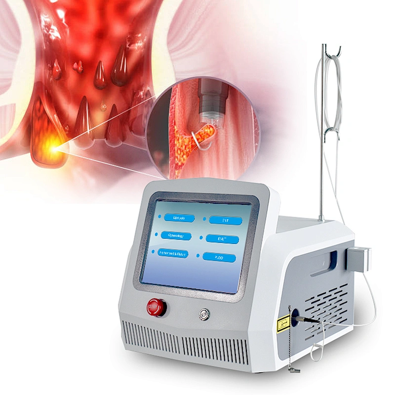 980nm 1470nm Hemorrhoid Laser Machine Anal Fistula Haemorrhoids Laser Treatment
